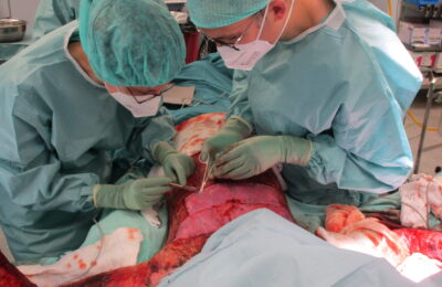 Bei einer Operation transplantieren zwei Ärzte Spenderhaut an einem Oberkörper eines verbrannten jungen Mannes.